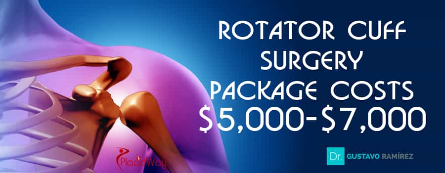 Price Package of Rotator Cuff Surgery in Jalisco, Mexico