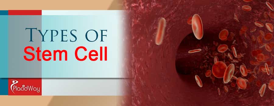 Types of Stem Cell Treatment for ALS