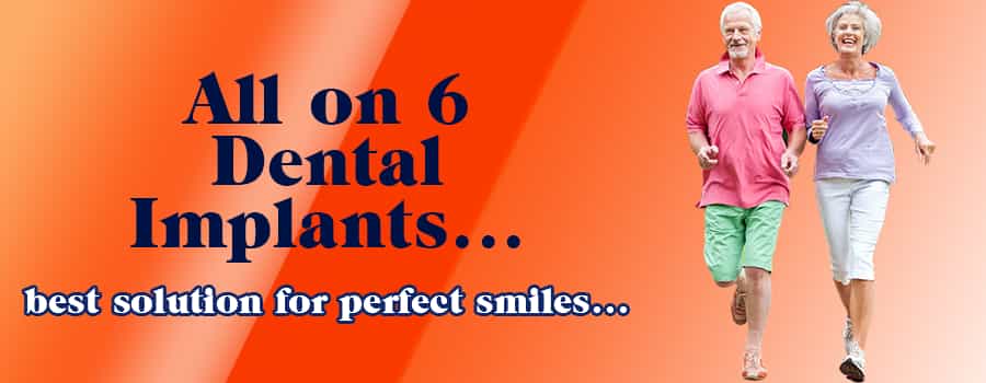 all-on-6-dental-implants-subtreatment-abroad-image1