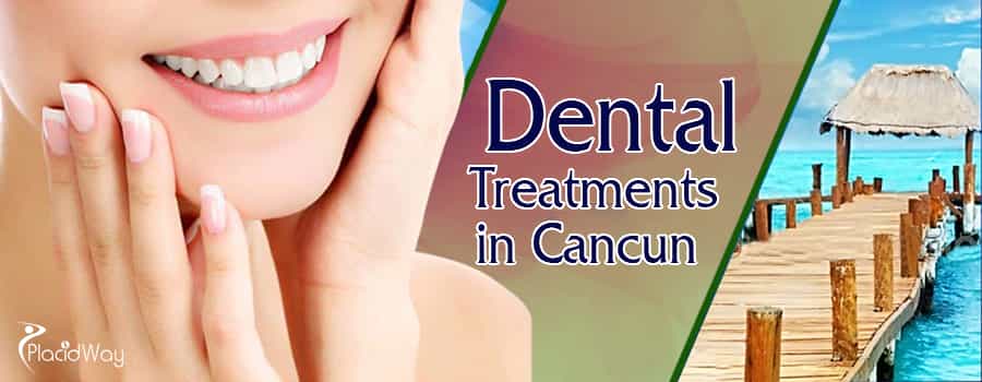 Dental Treatments in Cancun