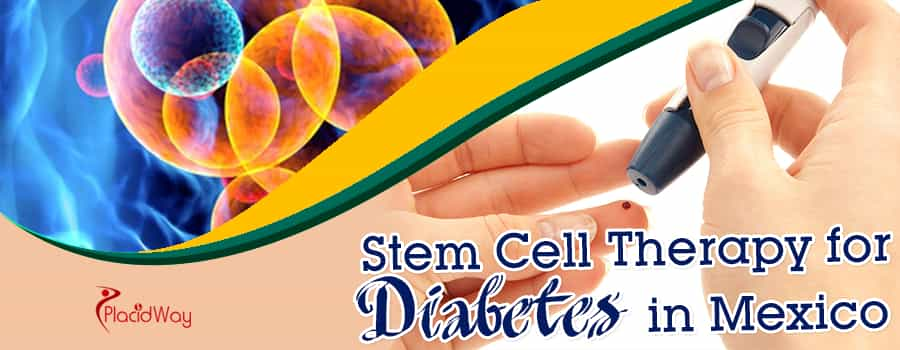 Stem Cell Therapy for Diabetes in Mexico