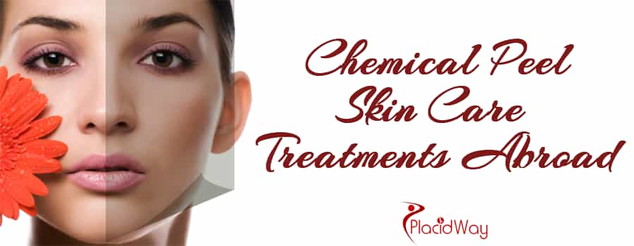Chemical Peel Skin Care Treatments Abroad