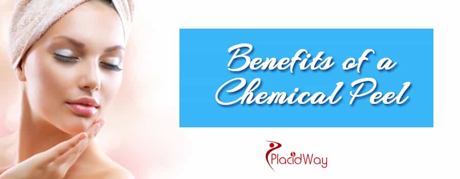 Benefits of Chemical Peel