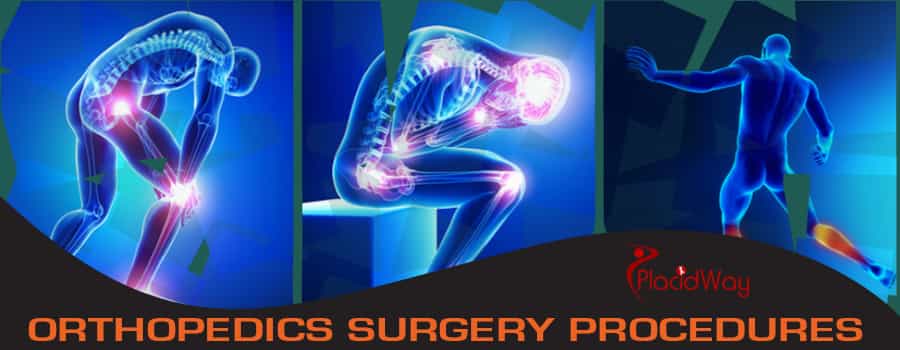 Orthopedics Surgery Procedures