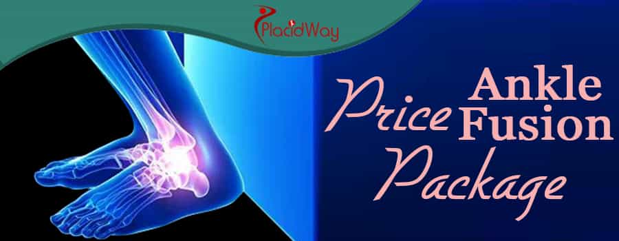 Price Package Ankle Fusion Surgery