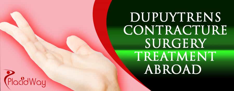 Dupuytrens Contracture Surgery Treatment Abroad