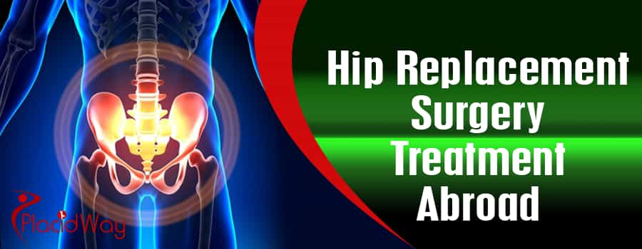 Hip Replacement Surgery Treatment Abroad