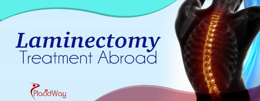 Laminectomy Treatment Abroad