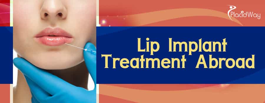 Lip Implant Treatment Abroad 
