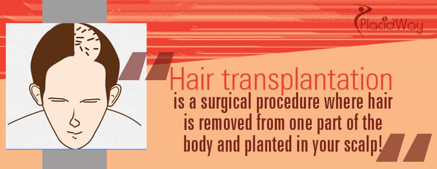 Hair Transplantation Procedure Abroad
