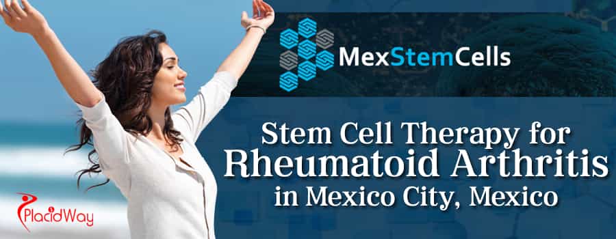 Stem Cell Therapy for Rheumatoid Arthritis in Mexico City Mexico
