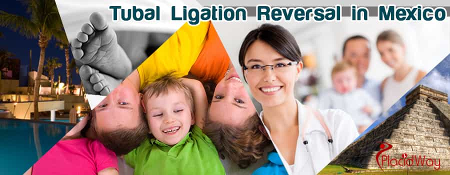 Tubal Ligation Reversal in Mexico