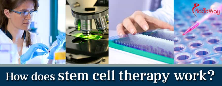 Mesenchymal stem cells 