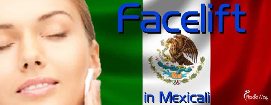 Face Lift in Mexicali, The cheapest face lift treatment in Mexico