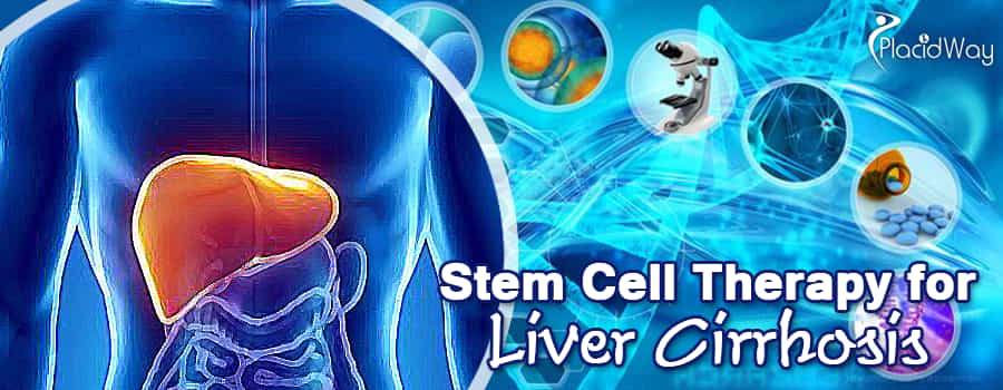 Liver Cirrhosis Treatments in Europe, Stem Cell Therapies for Liver Disease 