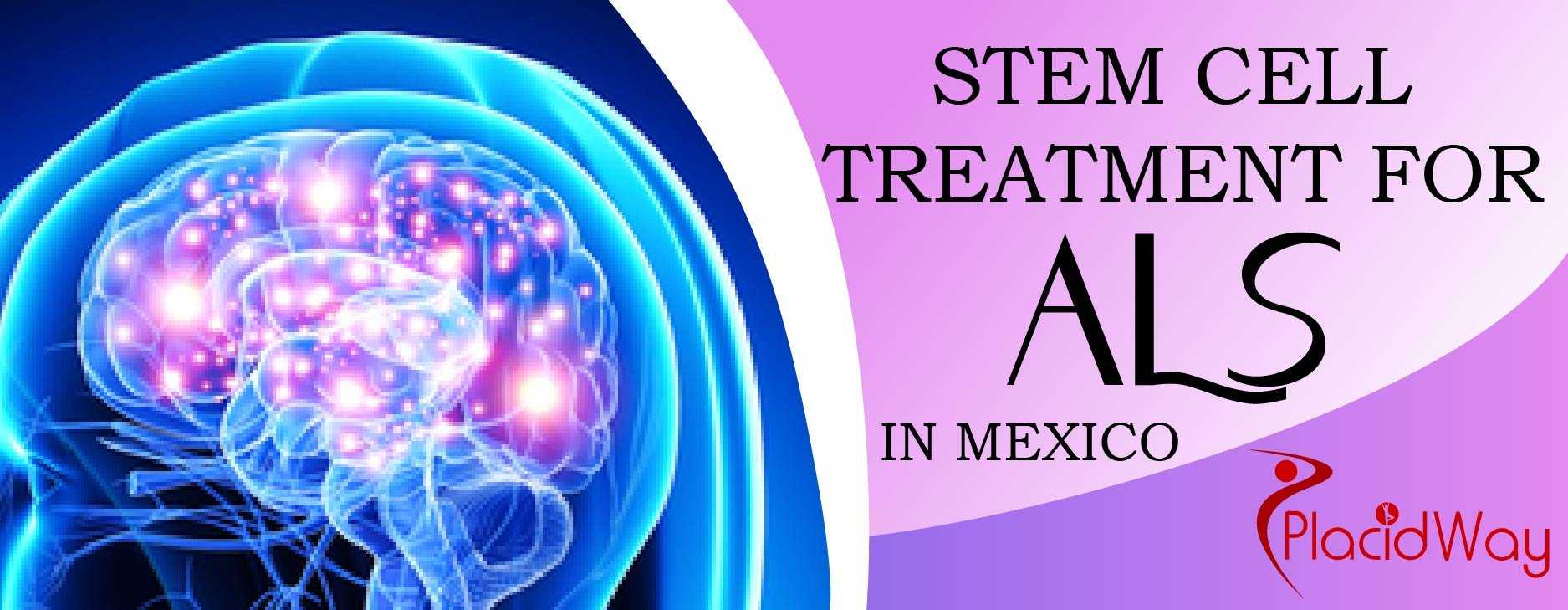 Stem Cell Therapy for ALS in Mexico