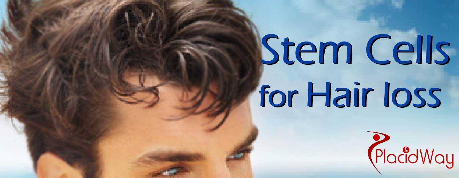 Stem Cell Treatment for Hair Loss