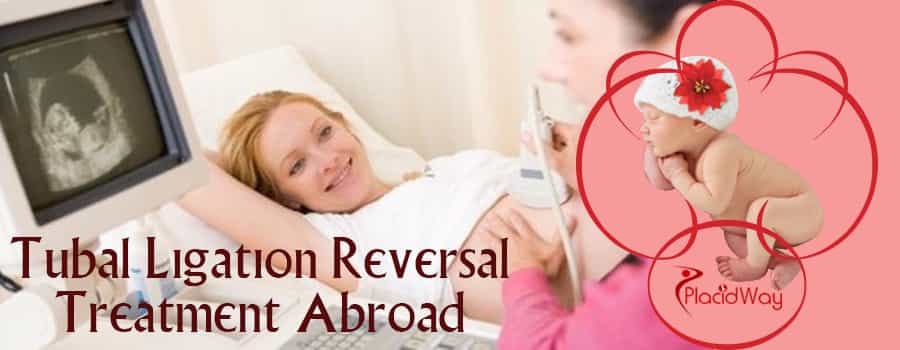 Tubal Ligation Reversal Treatment Abroad