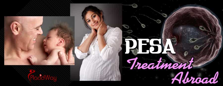 PESA Fertility Technique Treatment Abroad