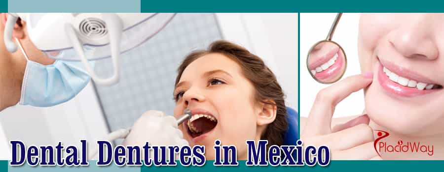 Denture in Mexico