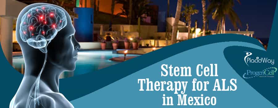 Stem Cell Therapy for ALS in Tijuana, Mexico