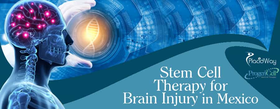 Stem Cell Therapy for Brain Injury Mexico