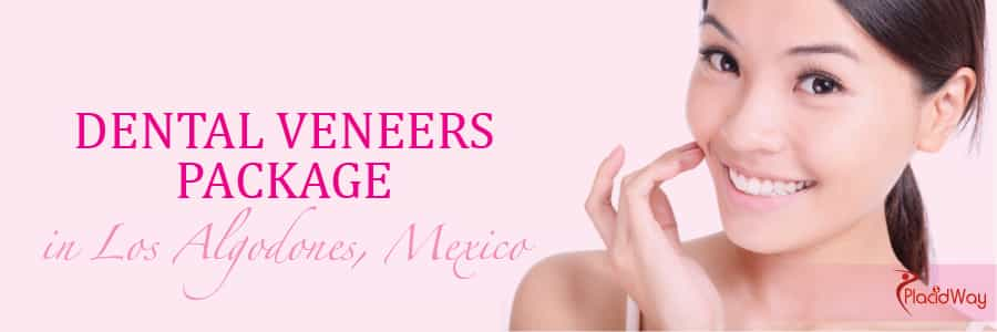 Dental Veneers Packages in Los Algodones, Mexico