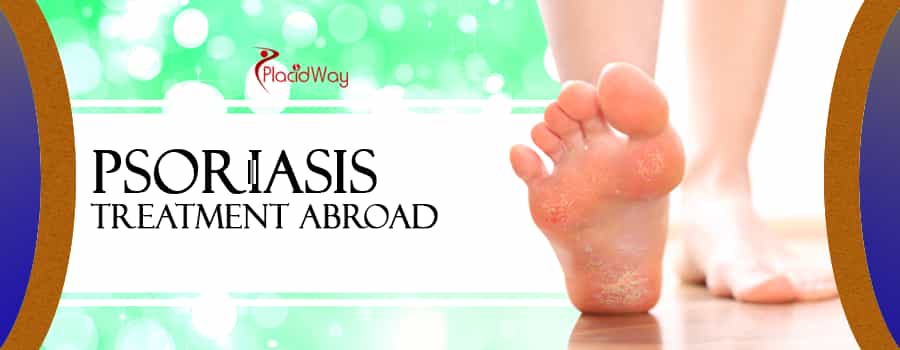 Psoriasis Treatment Abroad