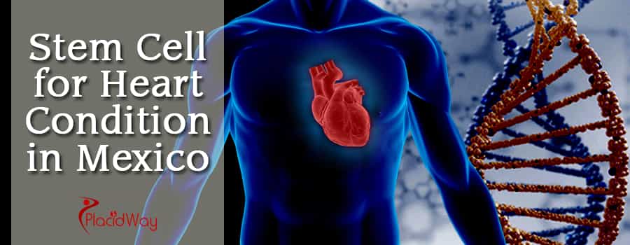 Stem Cell Therapy for Heart Condition in Mexico