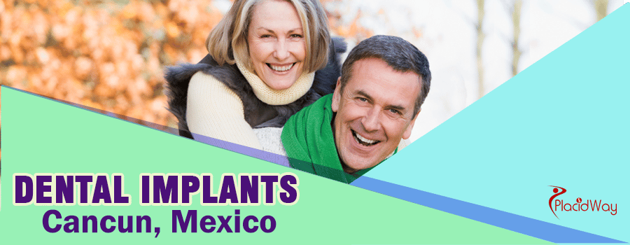 Dental Implants in Cancun, Mexico