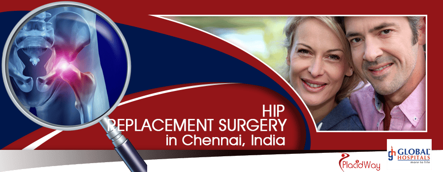 Hip Replacement Package in Chennai
