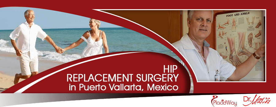 Hip Replacement Procedure