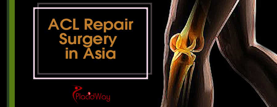 Affordable ACL Surgery Options in Asia