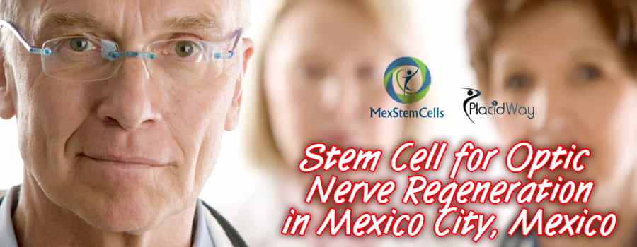 Stem Cell for Optic Nerve Regeneration in Mexico City, Mexico