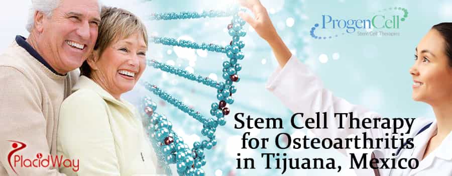 Stem Cell for Optic Nerve Regeneration in Tijuana, Mexico