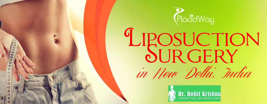Liposuction Package in New Delhi, India