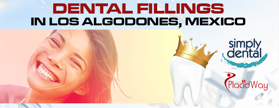 Dental Fillings