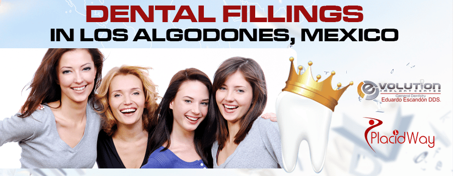 Top Quality Dental Fillings Package in Los Algodones, Mexico