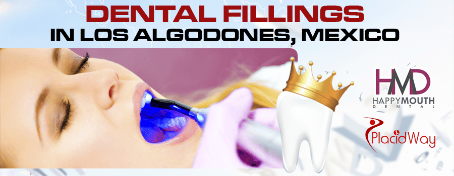 Dental Fillings