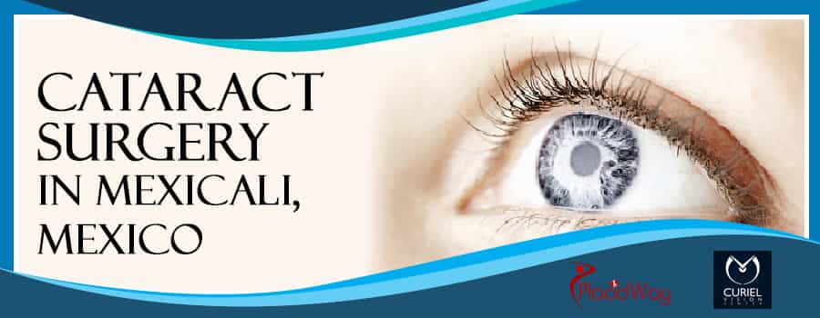 Top Cataract Surgery in Mexicali, Mexico