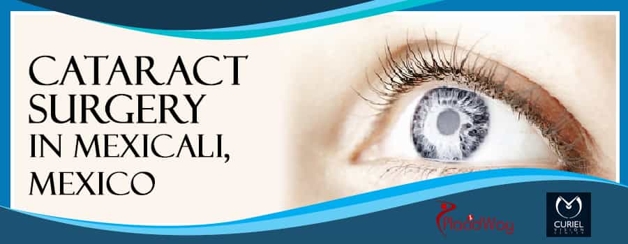 Top Cataract Surgery in Mexicali, Mexico Top Cataract Surgery in Mexicali, Mexico