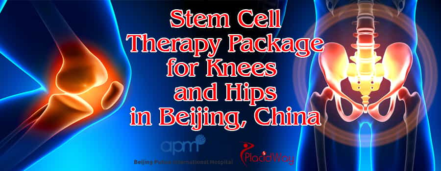 Stem Cell Therapy for Knees and Hips