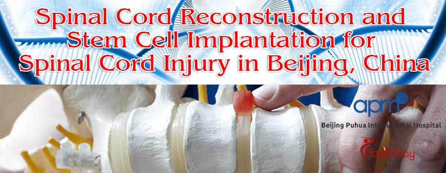 Spinal Cord Reconstruction and Stem Cell Implantation for Spinal Cord Injury in Beijing