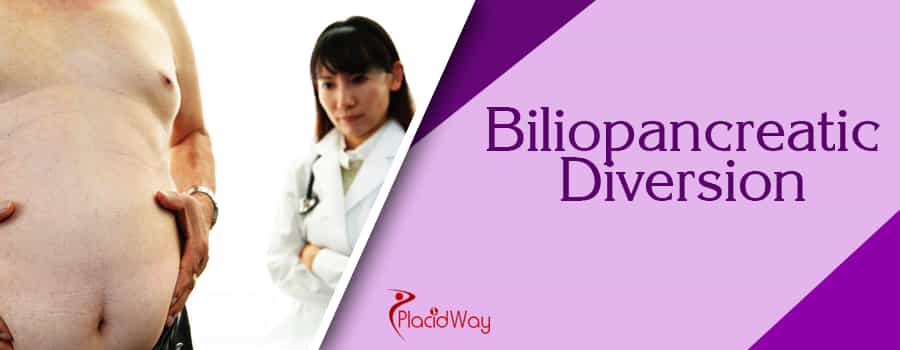 Biliopancreatic Diversion, Obesity Surgery, Bariatric Surgery