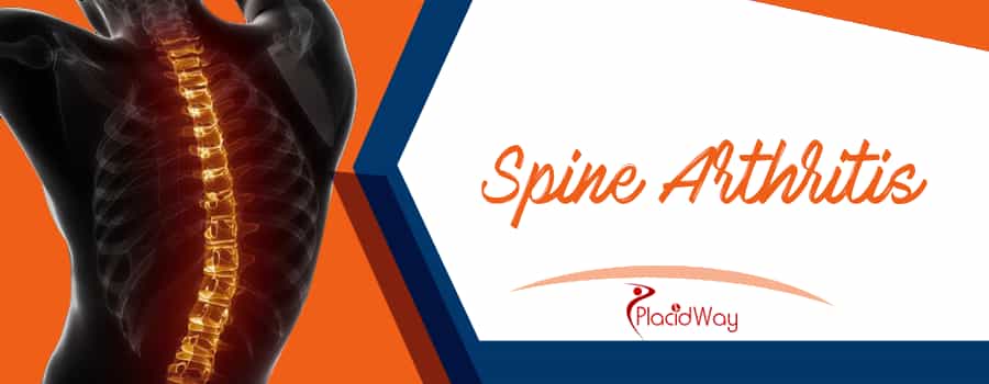 Spine Arthritis Treatment