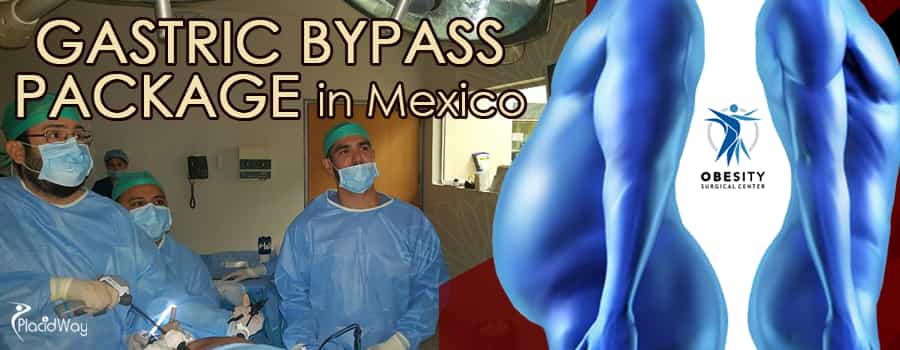 Gastric Bypass in Tijuana Mexico