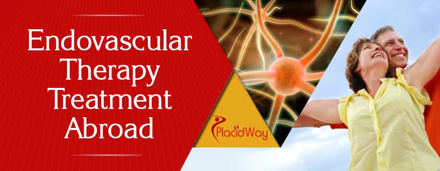 Endovascular Therapy Treatment Abroad