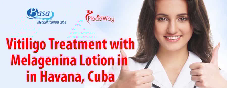 Vitiligo Treatment with Melagenina Lotion in Havana Cuba