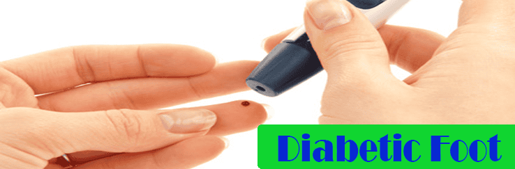 Diabetic Foot Treatment in Cuba