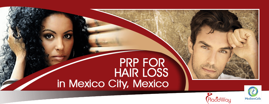 PRP for Hair Transplant in Mexico